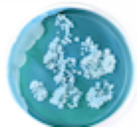 The image is blurry and does not provide clear details, making it difficult to accurately identify the picture's content. Based on the visual clues, It appears to be a pale circular shape that might be a petri dish containing a blue medium with lighter irregular structures distributed across it, which could potentially be bacterial colonies.